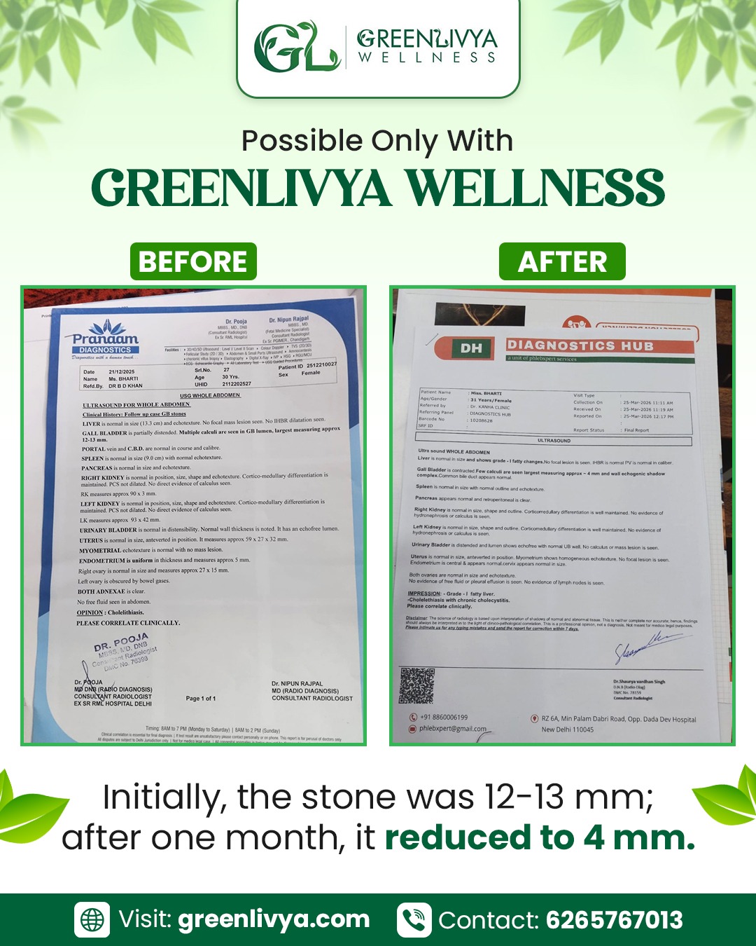 Prabhavi Syrup (Kidney Stone Removal) - Image 3